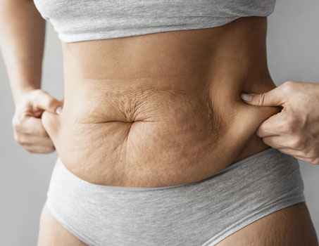Tratamento para Flacidez Corporal - DS Clinic Custom Beauty